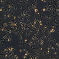 永生化肾小球系膜细胞系CIHGM-1