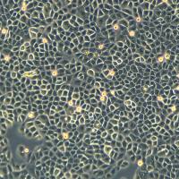 人原代表皮角质形成细胞CTCC-287-HUM