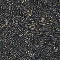  人原代肝星状细胞