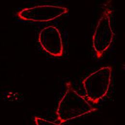 DiI(细胞膜橙红色荧光探针)