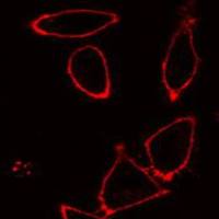 DiI(细胞膜橙红色荧光探针)