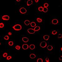 DiD（细胞膜红色荧光探针）