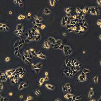 浙江(杭州)美森 高转移人肝癌细胞MHCC97-H