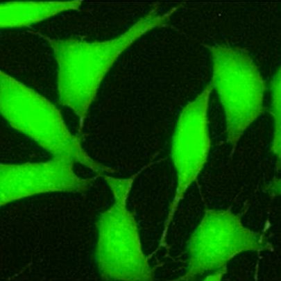 ROS活性氧检测试剂盒