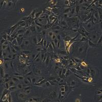 人肺癌细胞 NCI-H3255