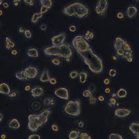 人结肠癌细胞 HT-55