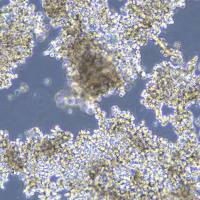 人小细胞肺癌 NCI-H2081