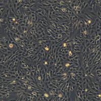 永生化人星形胶质细胞胎儿-SV40