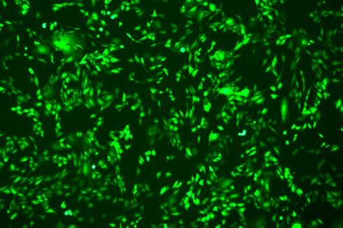 CRISPR/cas9基因敲入/插入细胞服务(荧光蛋白定点敲