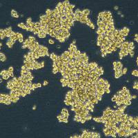 子宫内膜腺癌细胞 COLO 684