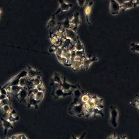 浙江美森 人肝癌细胞 HuH7