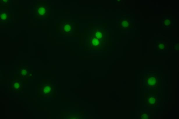 CRISPR/cas9基因敲入/插入细胞服务(荧光蛋白定点敲