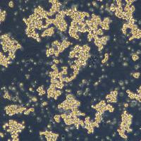 具有神经内分泌分化的前列腺癌细胞 LASCPC-01