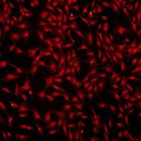 超氧化物阴离子荧光探针—DHE