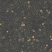 浙江（杭州）美森 永生化人脑微血管内皮细胞 hCMEC/D3