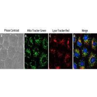 Lysosome Tracker (Red)(溶酶体红色荧光探针)