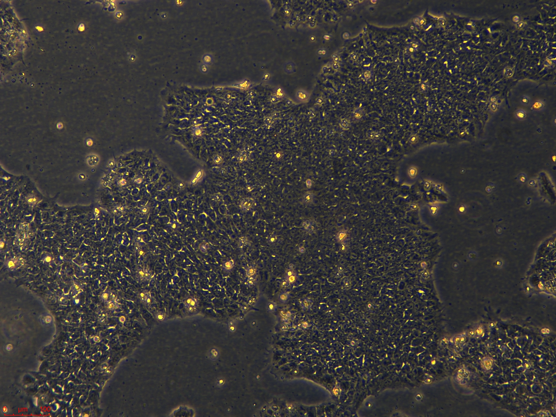 浙江（杭州）美森 外周血来源的iPSC细胞 hiPSC-Bl