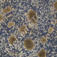 人套细胞淋巴瘤细胞 Granta-519