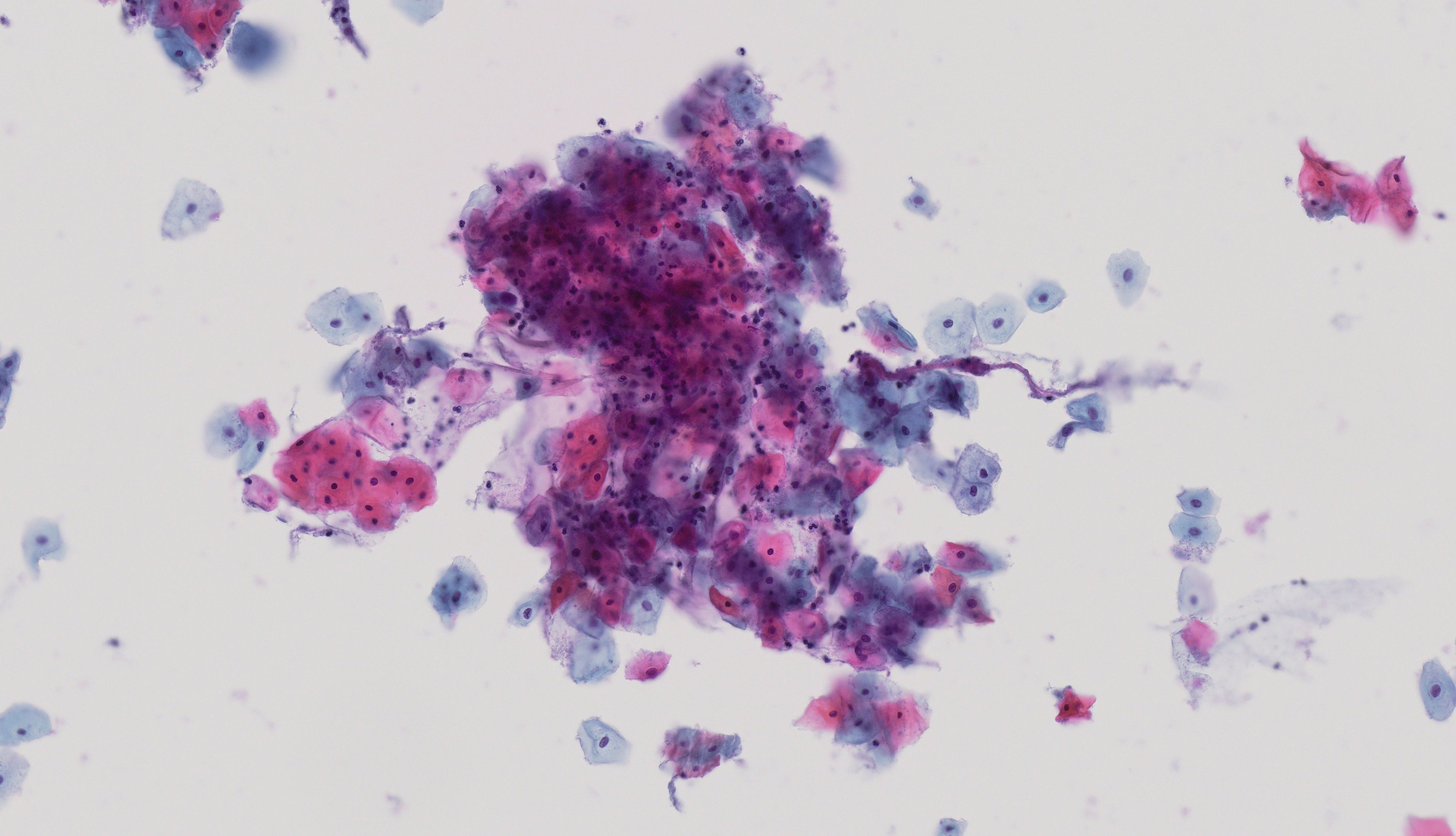 面对数智病理转型的荆棘之路，EVIDENT SLIDEVIEW系列化身破局利剑，为您披荆斩棘！