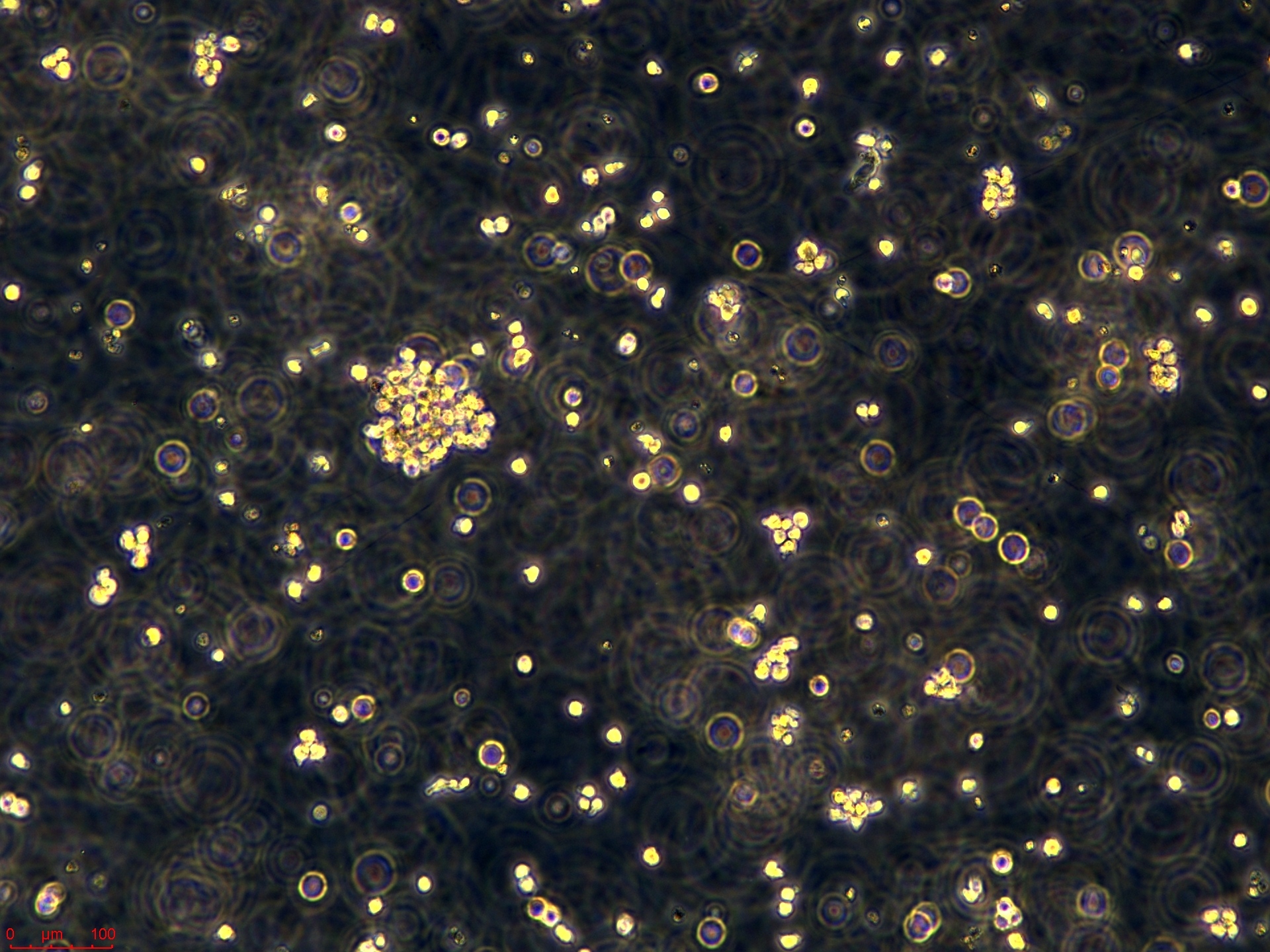 Jurkat 高的副本.jpg