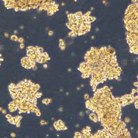 小细胞肺癌细胞 DMS79