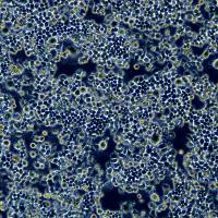 脑神经瘤细胞 Neuro-2a