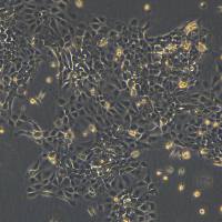 永生化人II型肺泡上皮细胞