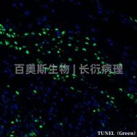 Tunel凋亡染色