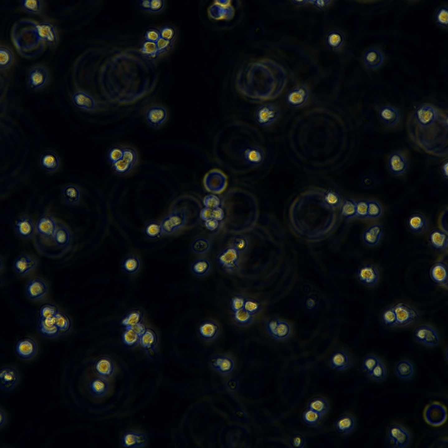 人急性T淋巴细胞白血病细胞Jurkat