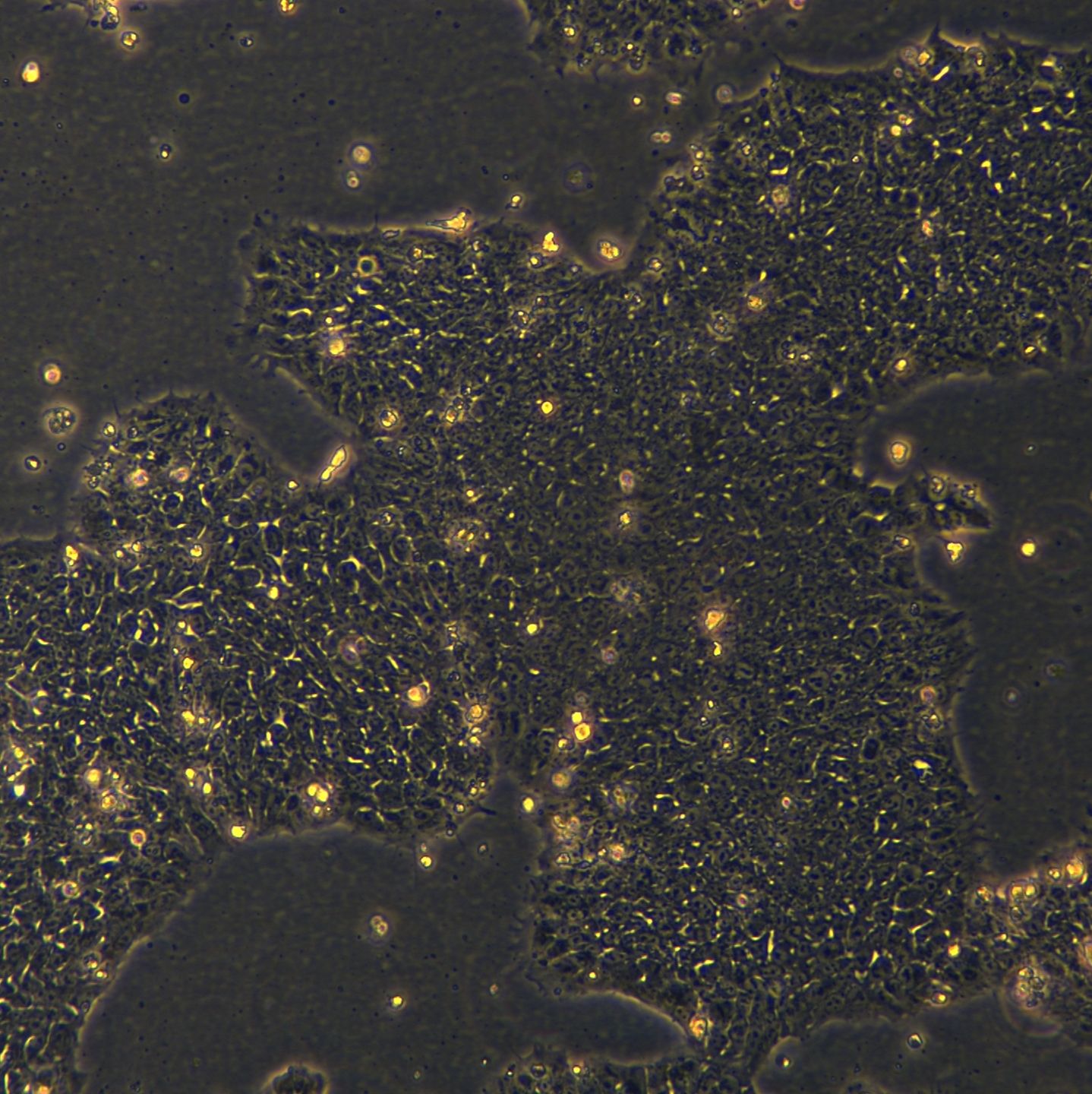 浙江（杭州）美森 外周血来源的iPSC细胞 hiPSC-Blood