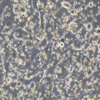 人直肠腺癌细胞 SNU-61