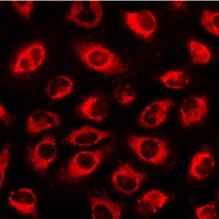 JC-1线粒体膜电位检测试剂盒