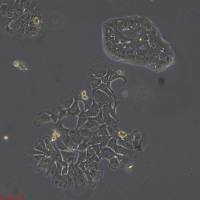 人肺腺癌细胞NCI-H1734 [H-1734, H1734] 现货