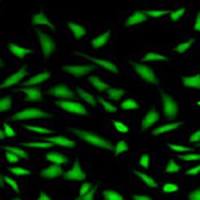 Fluo-3 AM(钙离子荧光探针,2mM)