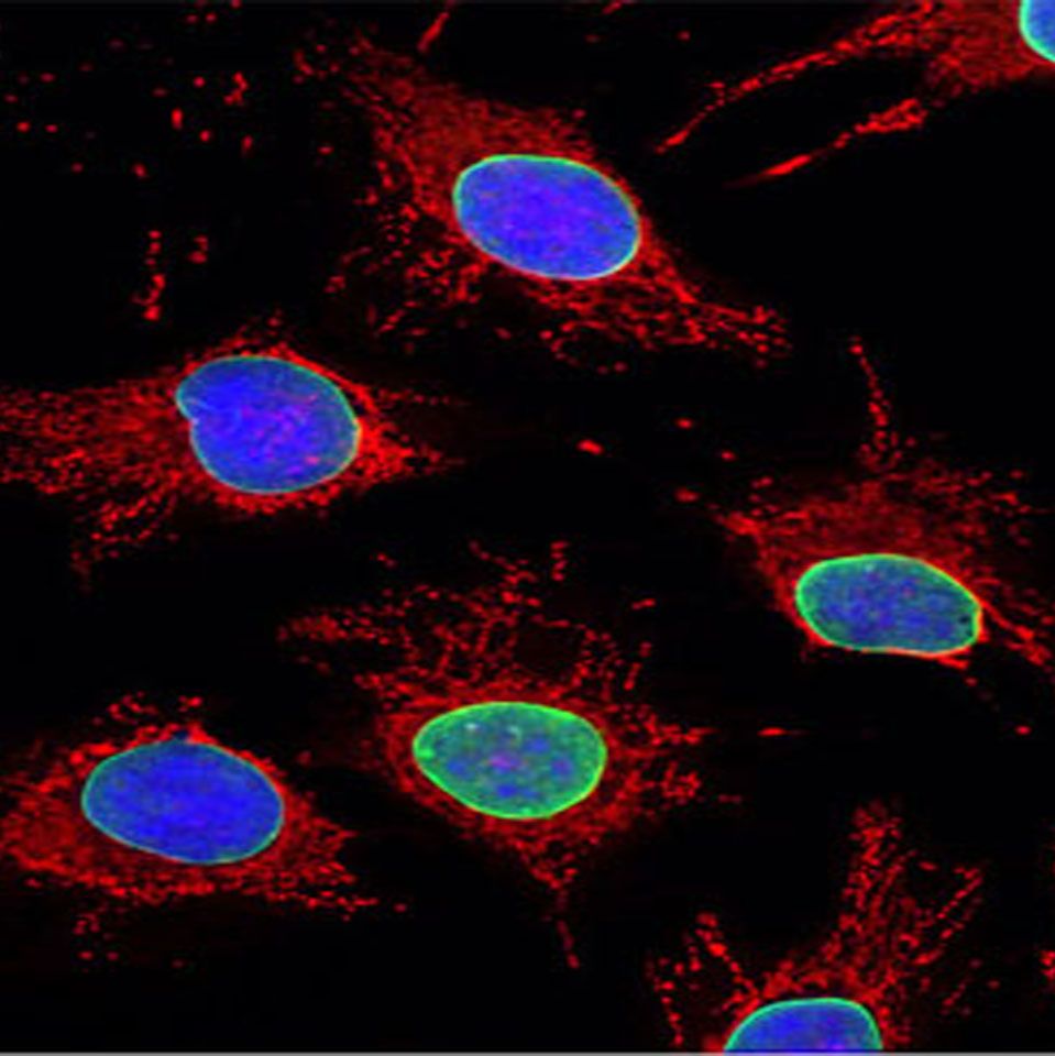 Mitochondrial Tracker (Red)(线粒体红色荧光探针)
