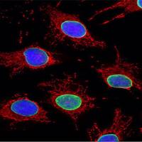Mitochondrial Tracker (Red)(线粒体红色荧光探针)