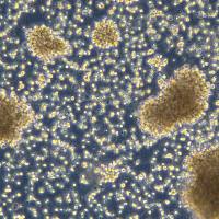 人B淋巴细胞 GM21867