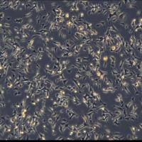 人神经母细胞瘤细胞 SH-SY5Y