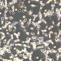 人神经母细胞瘤细胞 IMR-32