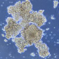 人小细胞肺癌 NCI-H1436