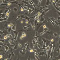 小鼠胚胎成纤维细胞 BALB3T3cloneA31