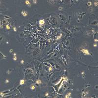 人胰腺癌细胞 Panc 02.13