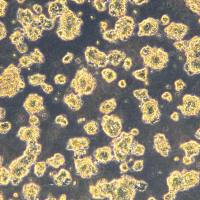 人肺小细胞癌细胞 DMS 454