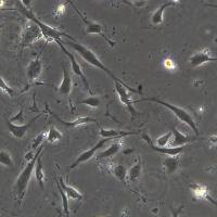 人脐静脉内皮细胞HUVEC-C