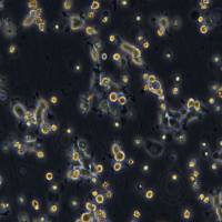 浙江美森-人咽鳞癌顺铂耐药株 FaDu/DDP