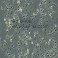 小细胞肺癌NCI-H345（悬浮）