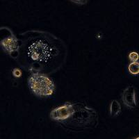 人舌鳞状细胞癌 SCC-15