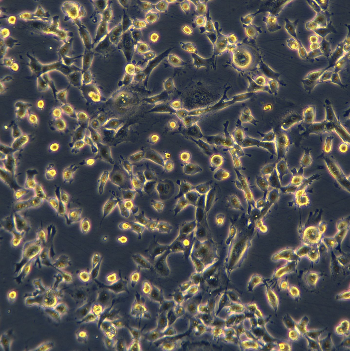 肺间皮瘤细胞NCI-H2052