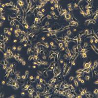 肺间皮瘤细胞NCI-H2052