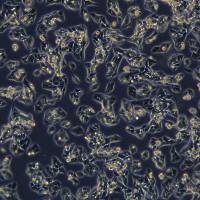 小鼠前列腺癌细胞 myc-cap